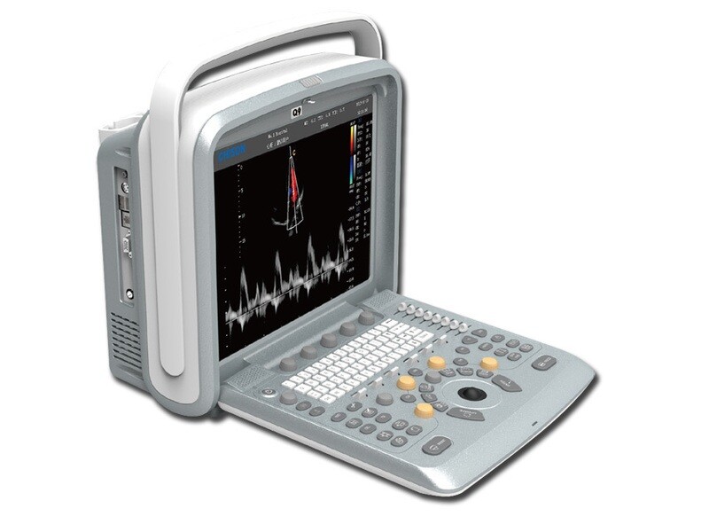 CHISON Q9 PORTABLE COLOURDOPPLER + 4D PROBE AND SOFTWARE