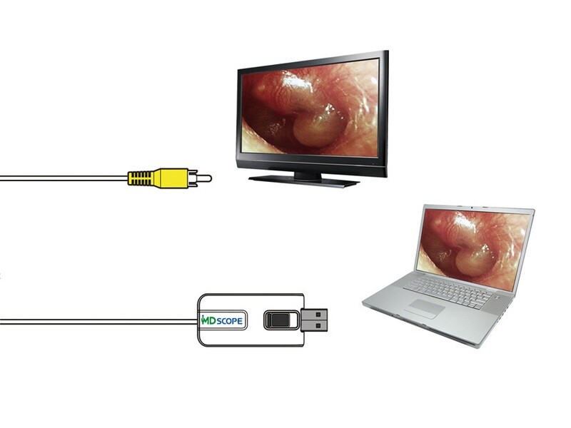 MD SCOPE VIDEO OTOSCOPE - ELITE PACK