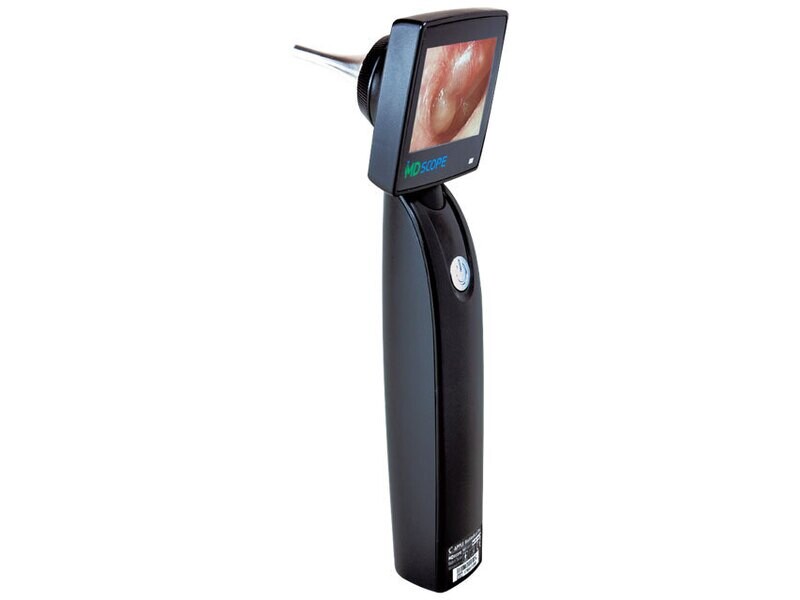 MD SCOPE VIDEO OTOSCOPE - DELUXE ZIPPER PACK 4 PROBES