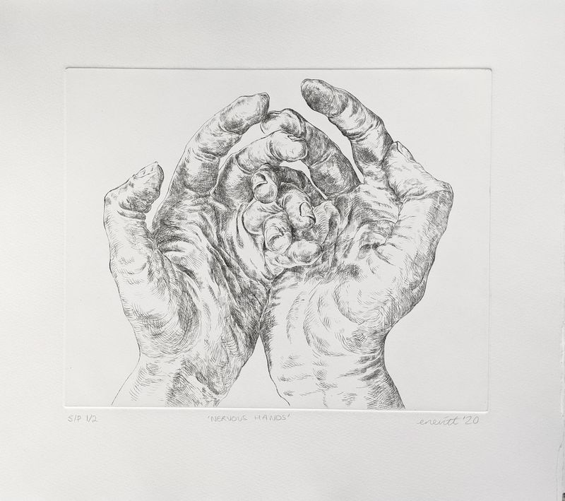 Nervous Hands