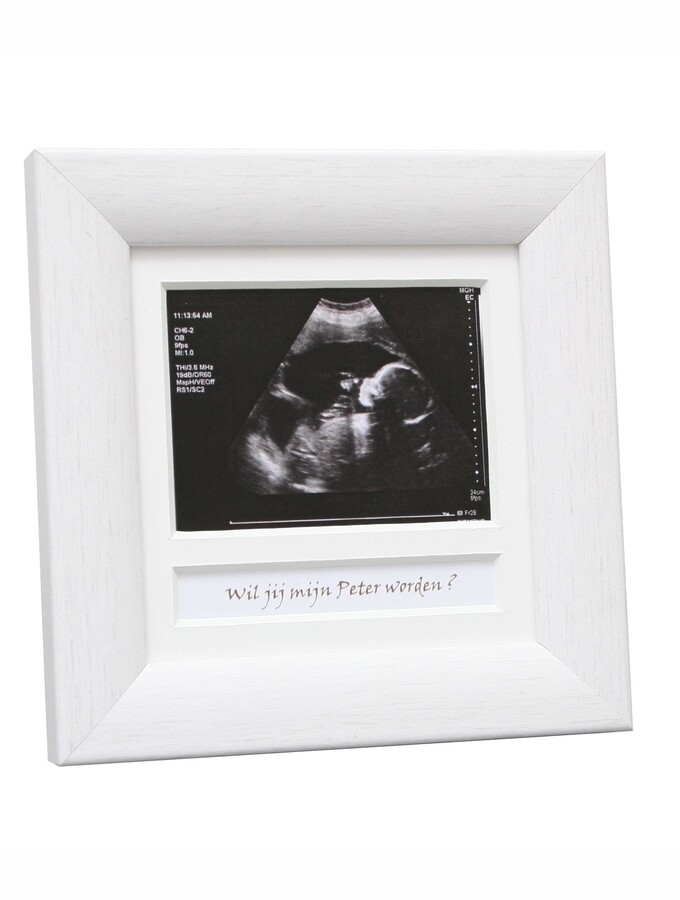 Kader voor Echo Nederlandse tekst