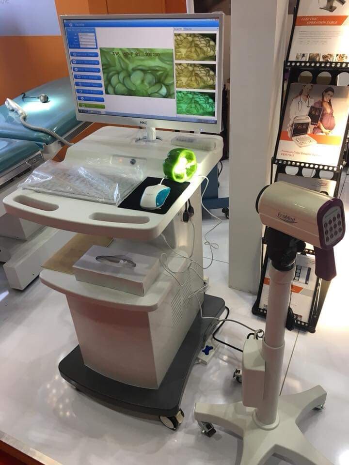Digital Video Colposcope