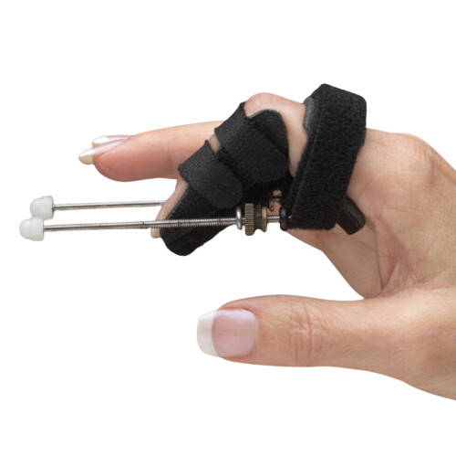 Static Progressive PIP Finger Extension Splint