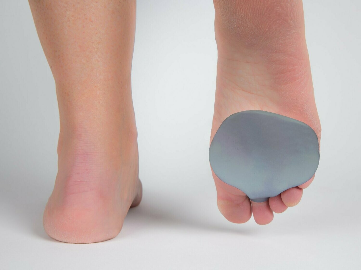 OrthoPÄD Vorfußeinlage aus Silinan® (100% Silikon),  1 Stück nicht verpackt, Einheitsgröße