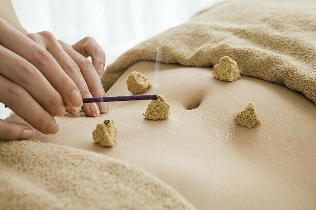 Moxibustion