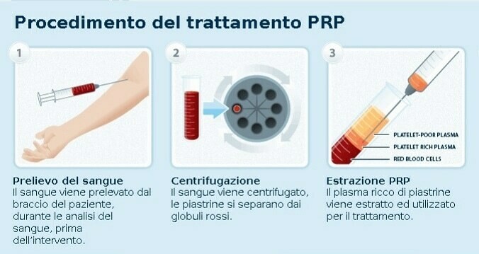 Prodotti e Cure Post-Intervento