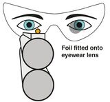 Evolution i-Spot Eye Dominance Correction Foils (Advanced Pack)