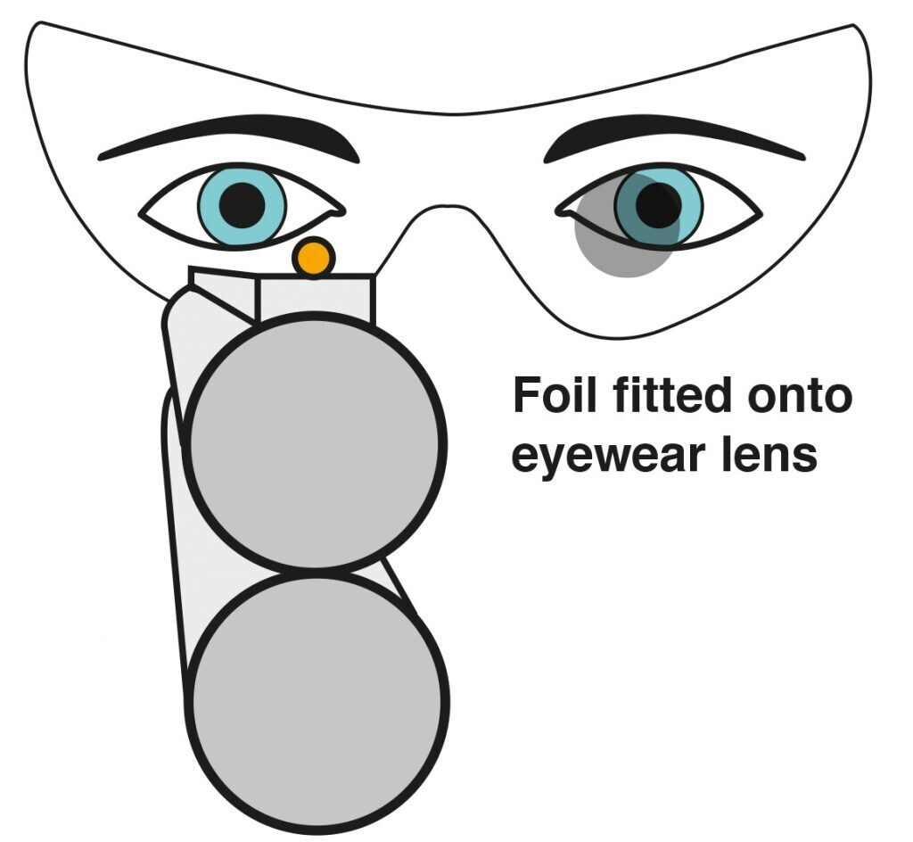 Evolution i-Spot Eye Dominance Correction Foils (Advanced Pack)