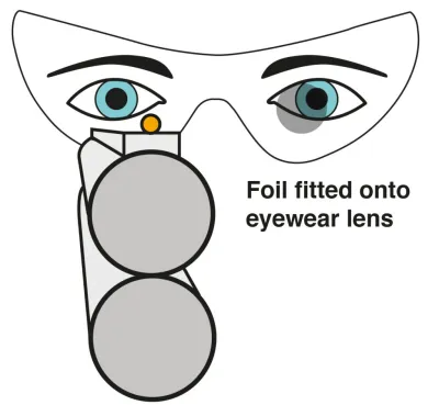 Evolution i-Spot Eye Dominance Correction Foils (Standard Pack)