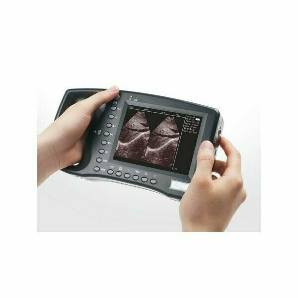 Ecógrafo WED-2000A con sonda