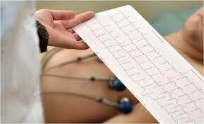 ELECTROCARDIOGRAFOS