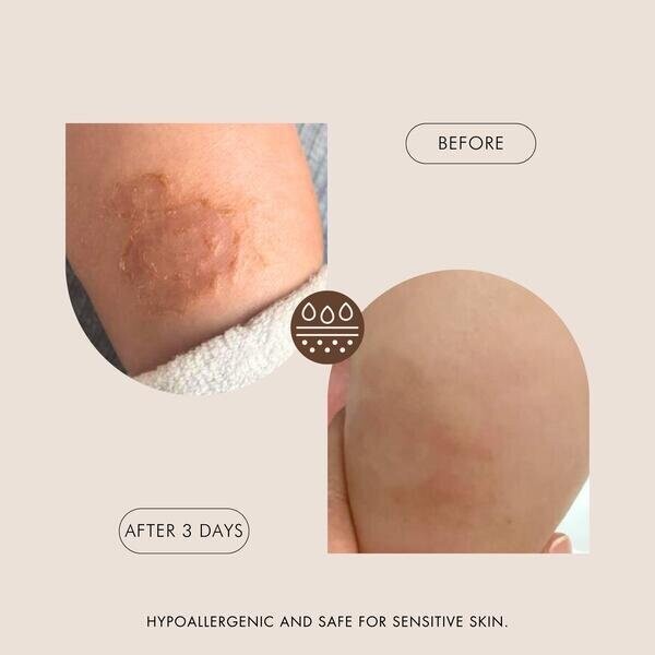 Miracle Soothing Baby Body Butter