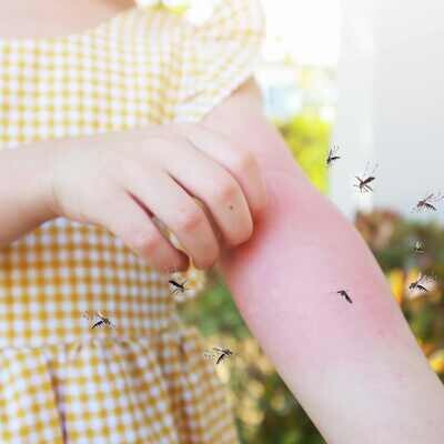 Mosquito Bite Relief