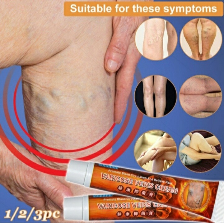 3Pcs Tratamiento De Venas Varicosas Crema vasculitis Flebitis Araña Pierna Ungüento Hierba Yeso Medico