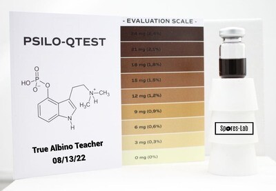 True Albino Teacher Genetics