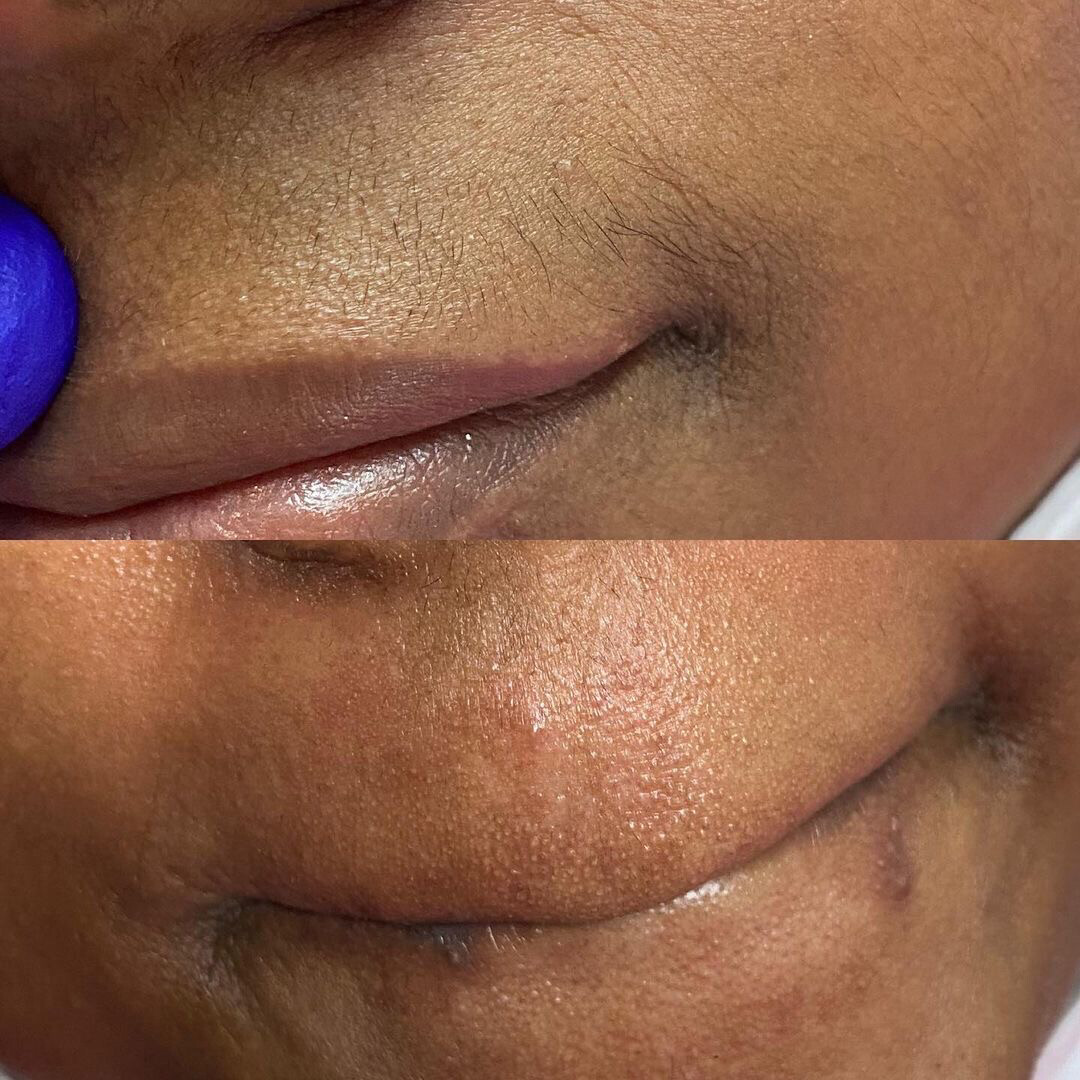 Lip Waxing