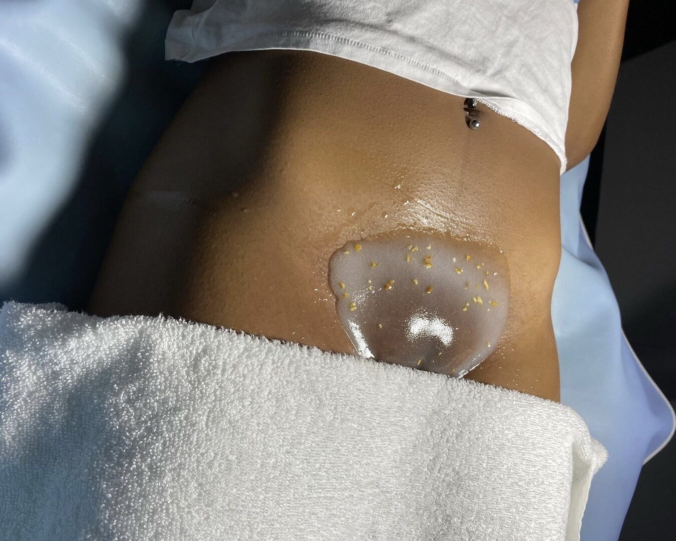 Vajacial Treatment