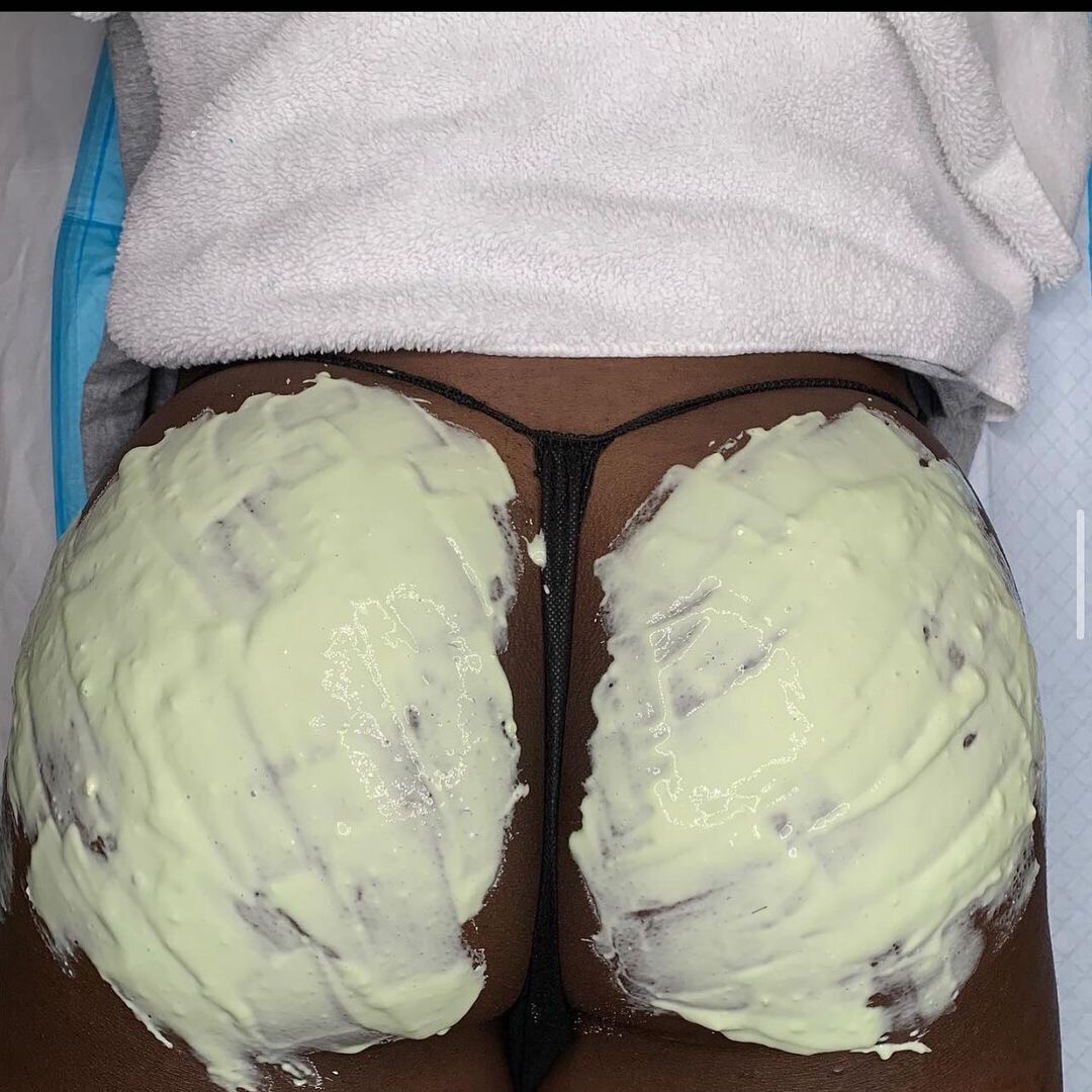 Buttocks Rejuvenation Treatment
