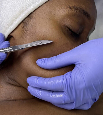 Dermaplane Glow Facial: Smooth, Refresh, Radiate