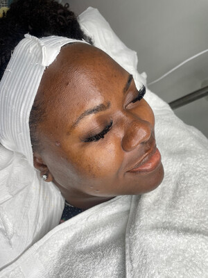 Revitalize and Renew: Deep Cleansing Facial for Both Men and Women
