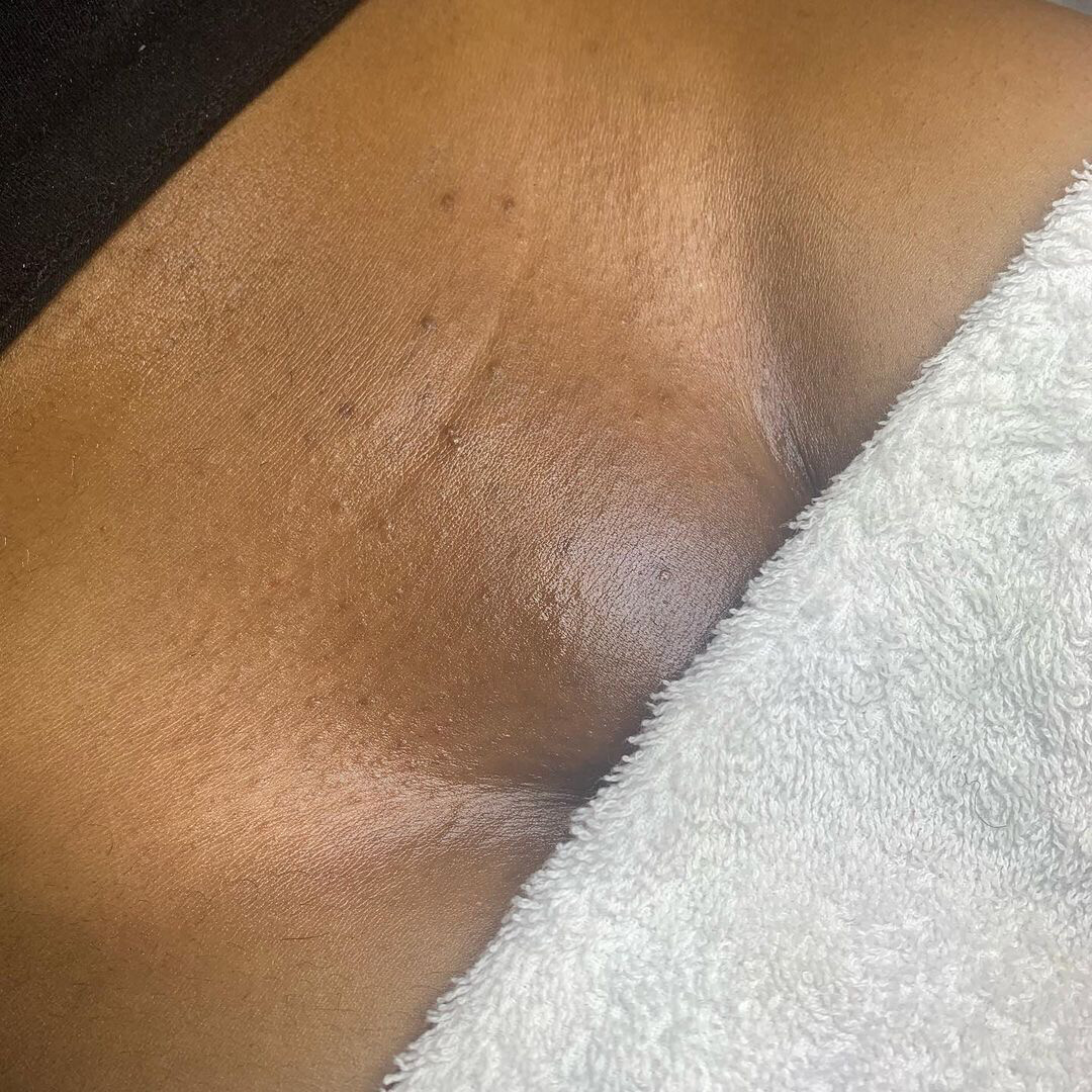 Brazilian Wax