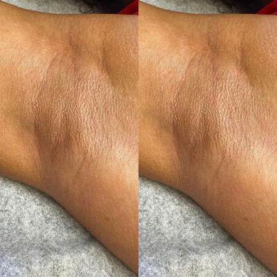 Underarm Wax ( Female )