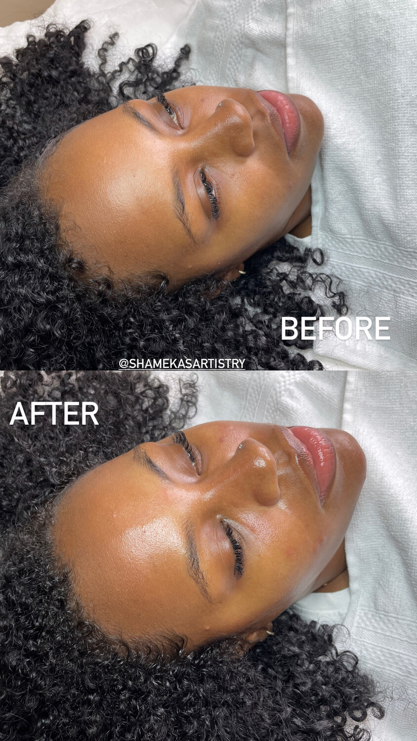 Tier 3: The Elite Skin Reset Facial