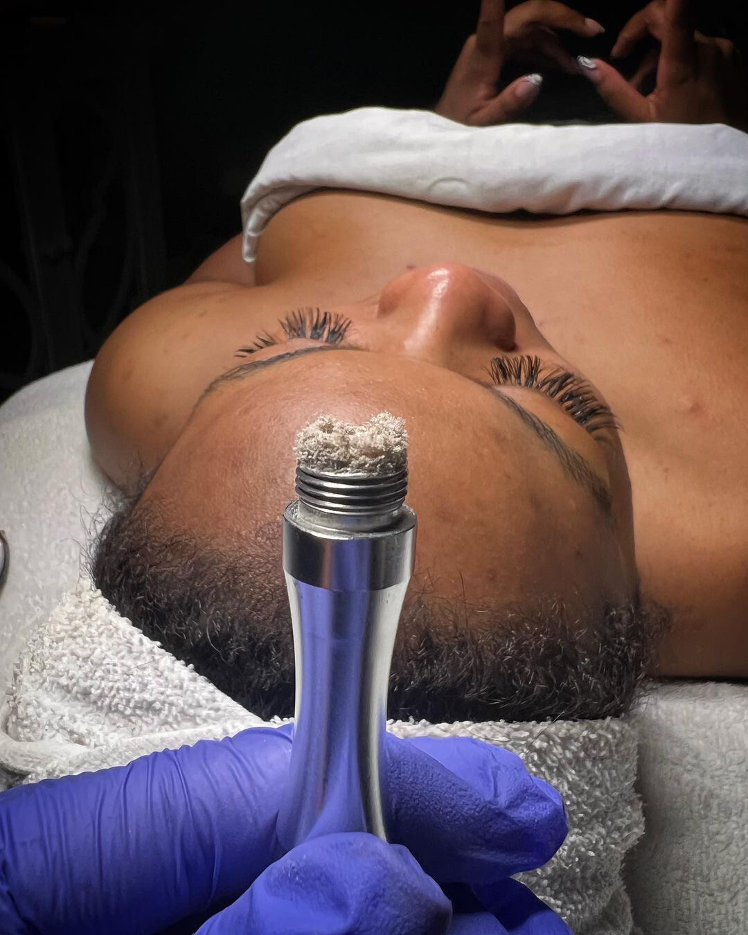 Tier 2: Precision Glow Resurfacing Facial