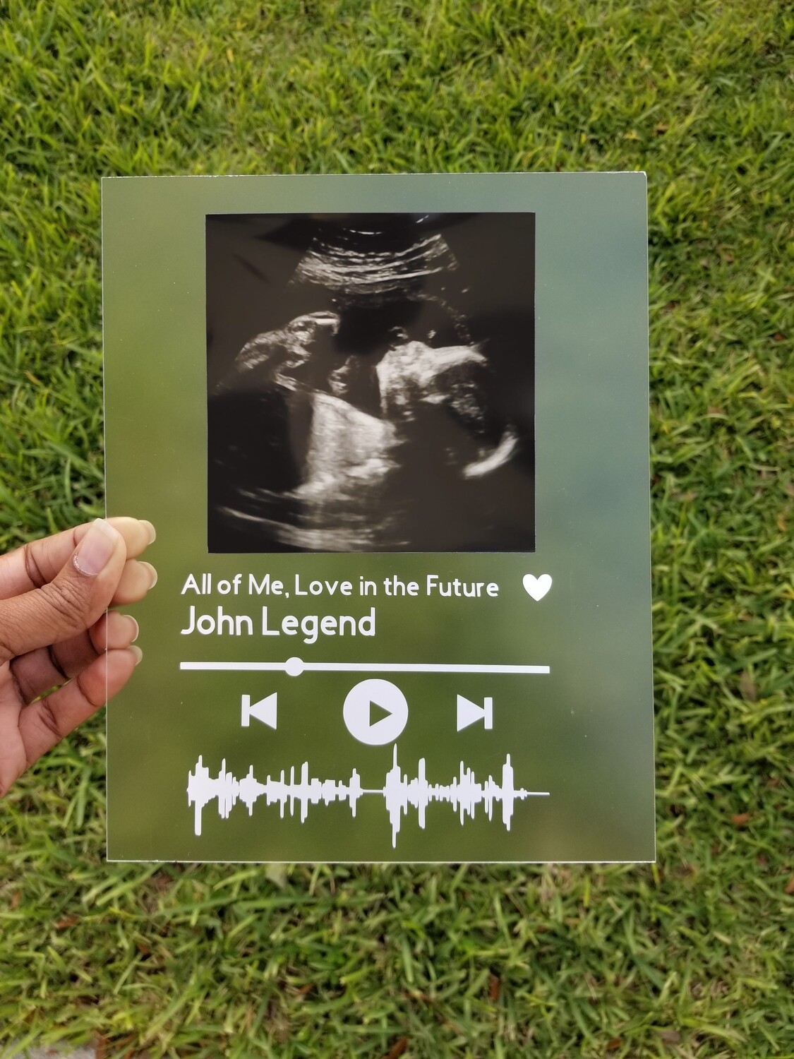 Customized Ultrasound glass art (frame not included)