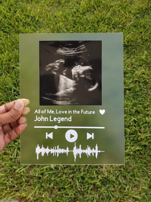 Customized Ultrasound glass art (frame not included)
