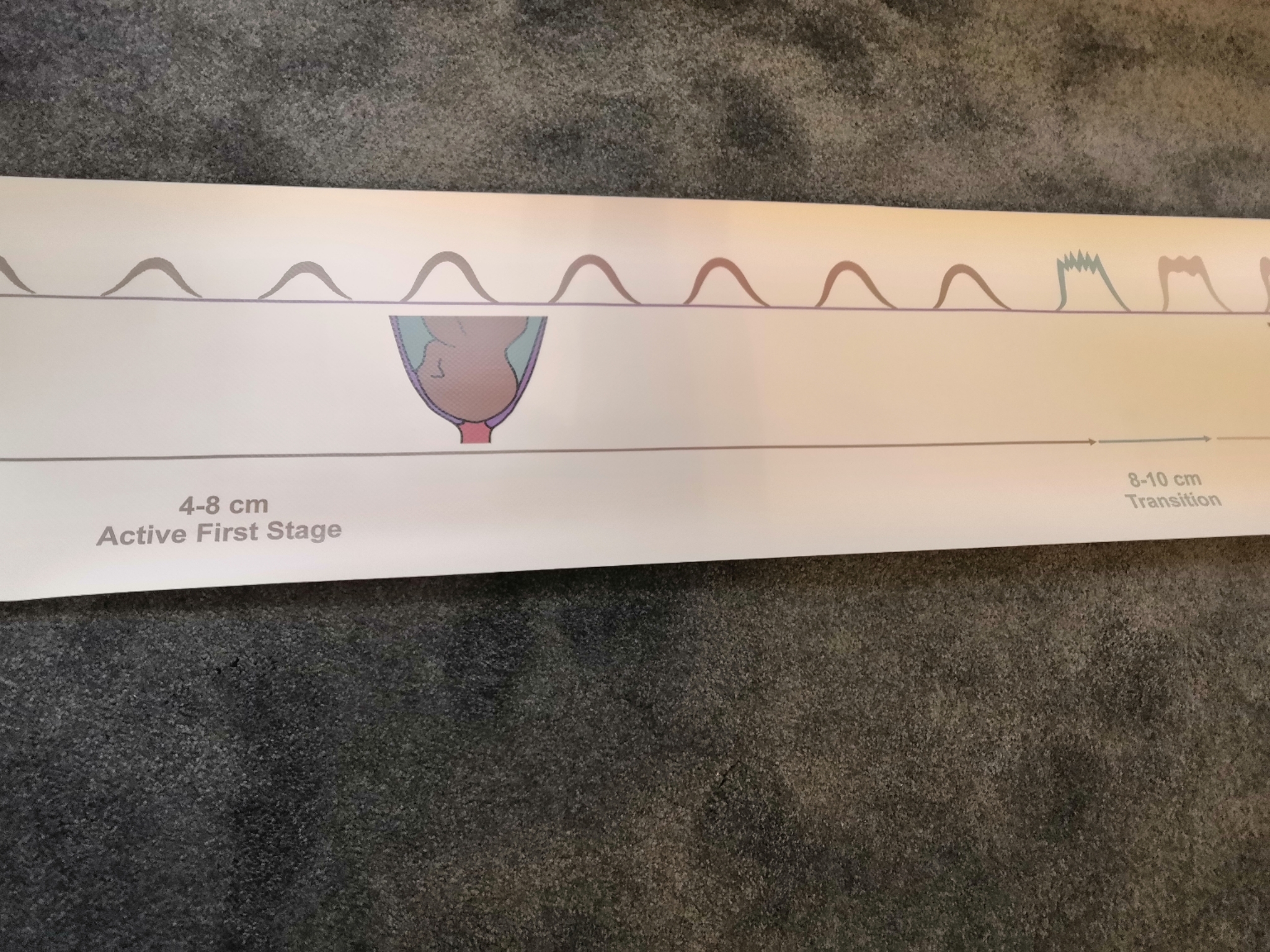 Childbirth Education Posters Labour Timeline Banner Childbirth Education Posters Labour Timeline Banner