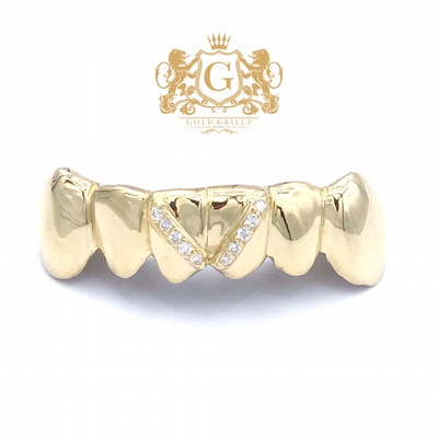 Gold Grillz + Diamonds Strip