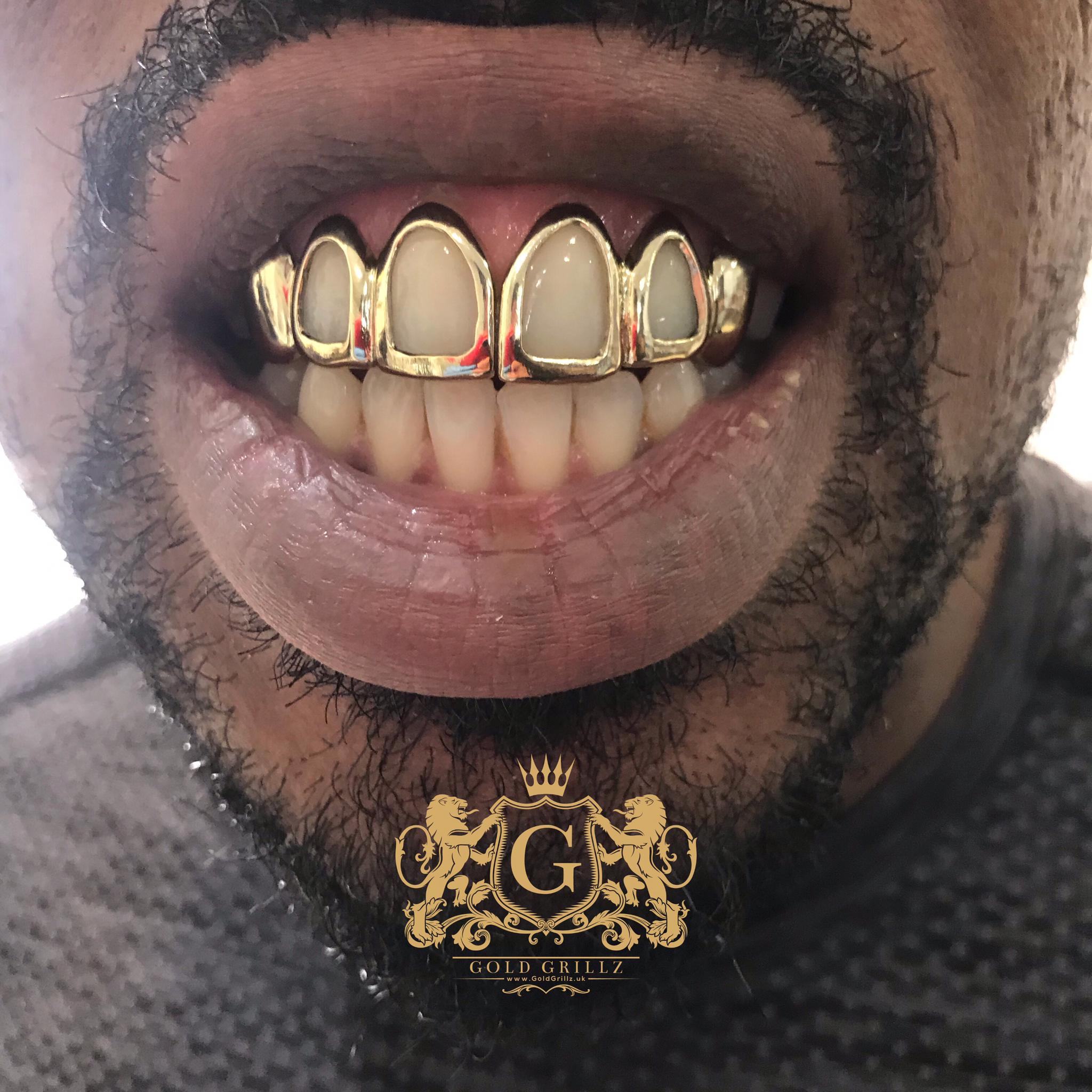 Full Sets of Gold Grillz with 4 Window Design from £350