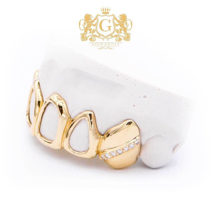 Gold Grillz - Windows &amp; Diamonds Strip