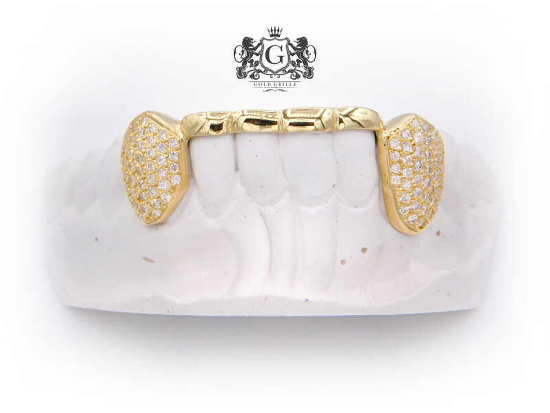 Iced Out Canines &amp; Gold Bar