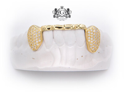 Iced Out Canines &amp; Gold Bar