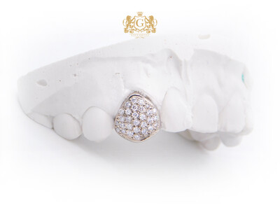Single tooth iced with diamonds