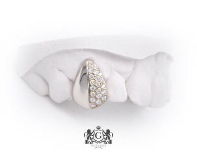 Half iced diamond tooth