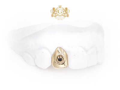 Smiley Face Tooth