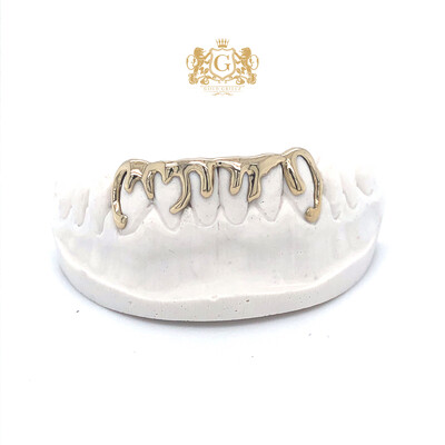 Gold grillz - Gold drip design