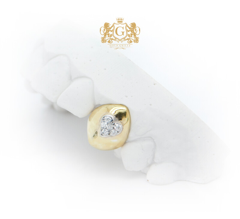 VVS Diamond Teeth & Grillz