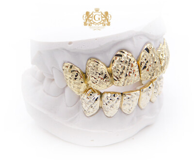 Miami Diamond Cut - Upper &amp; Lower gold grillz