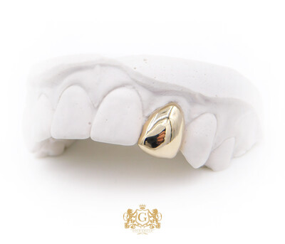 Single Gold Tooth