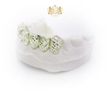 Miami Diamond Cut Lower Grillz