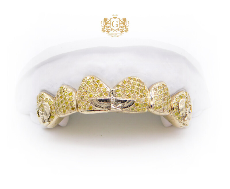 VVS Diamond Teeth & Grillz