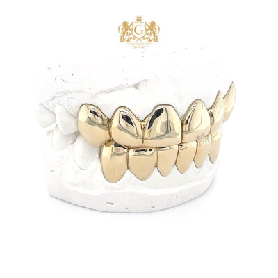 Upper &amp; Lower gold grillz