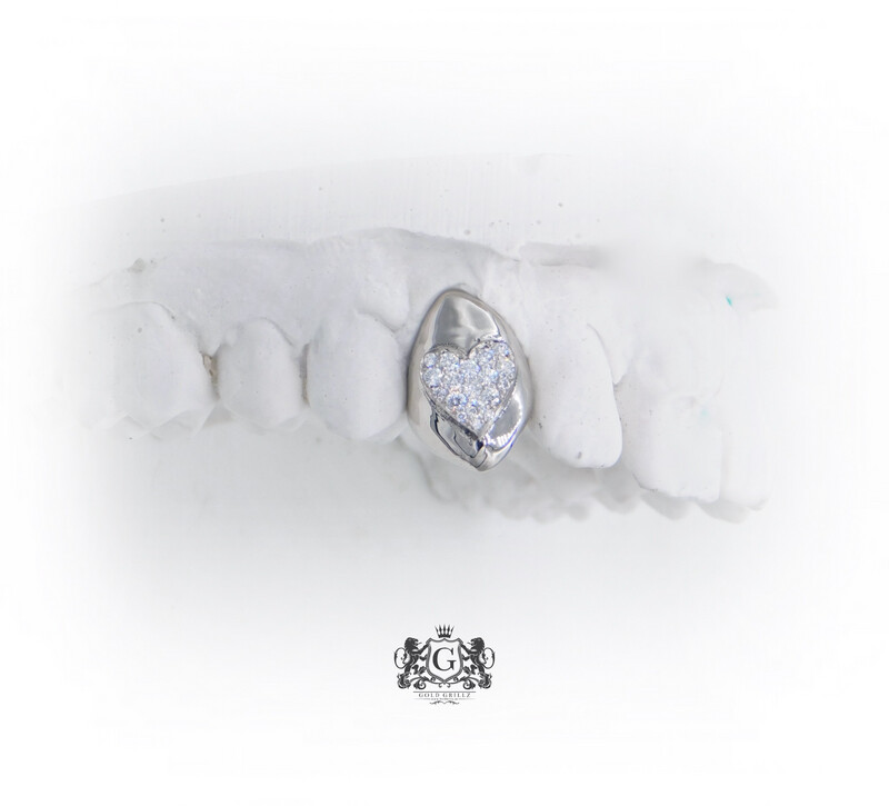 Diamond Heart Gold Tooth