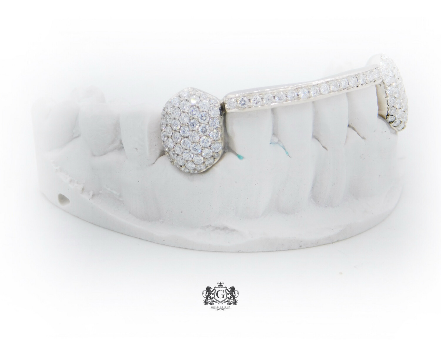 Iced out grillz price outlet