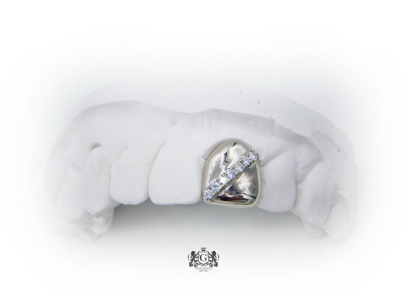 Gold tooth with diamonds strip