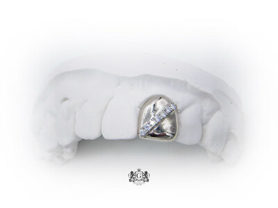 Gold tooth with diamonds strip